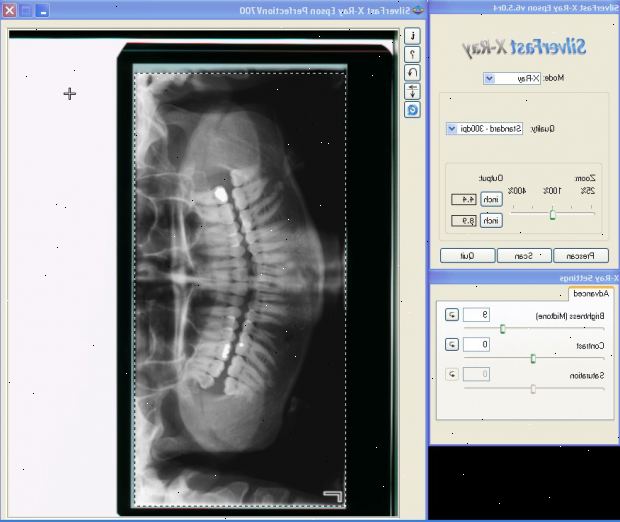 Röntgenkuvat. osallistuvan henkilöstön x-ray tutkimuksiin ja hoitoon.