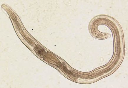Threadworm (pinworm). Miten tartunnan levitä?